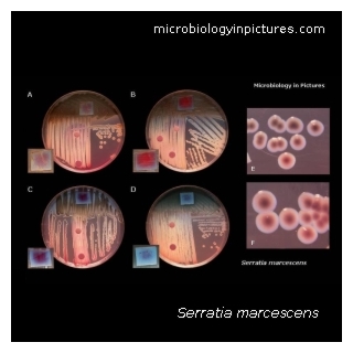 serratia